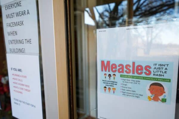 US measles cases. UU. They reach the highest number in 33 years: CDC