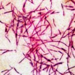 PHOTO: In this file photograph you can see the Legionnaires' disease bacteria.