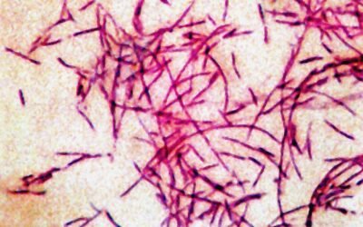 PHOTO: In this file photograph you can see the Legionnaires' disease bacteria.