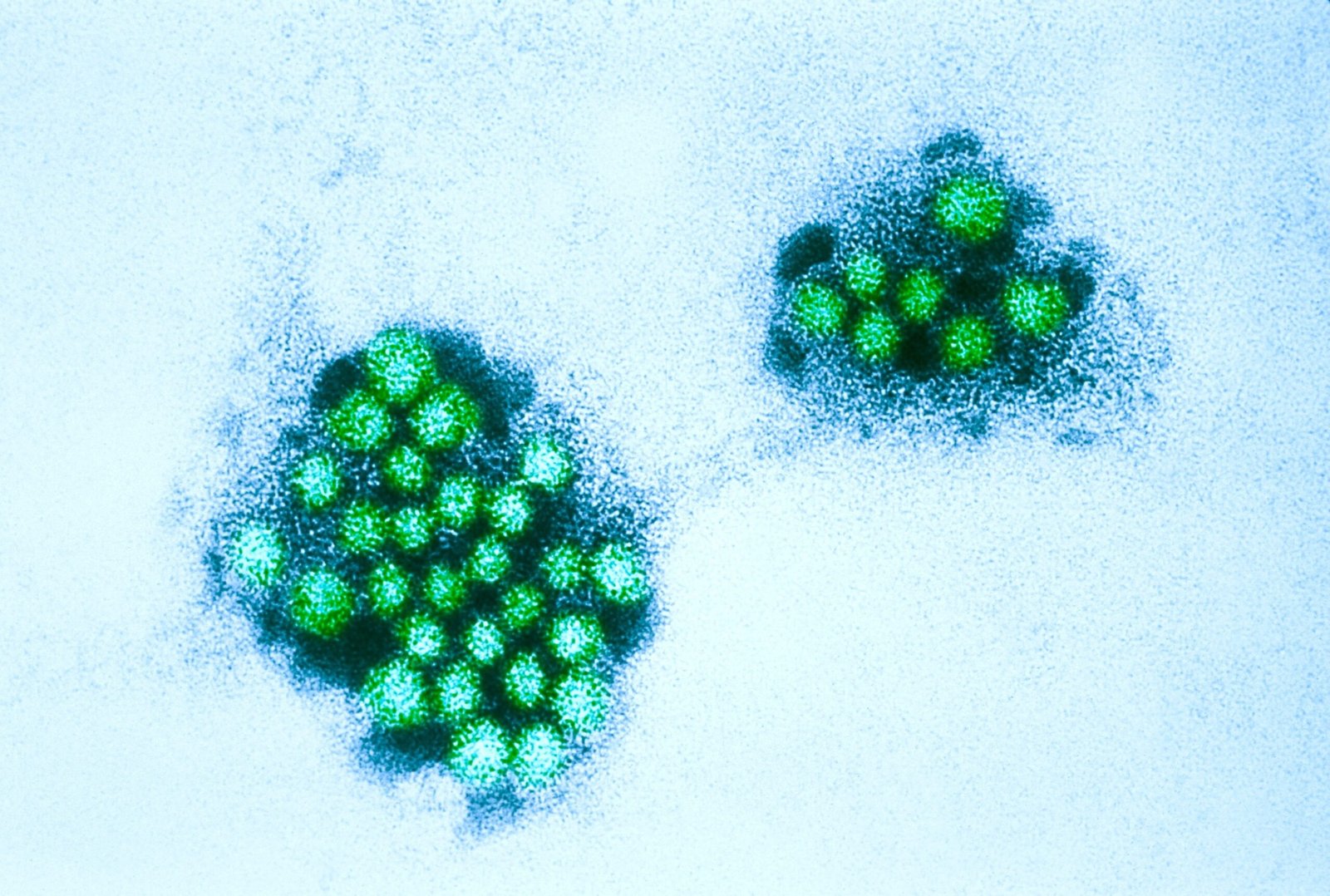 Norovirus cases rise in Los Angeles County: health officials
